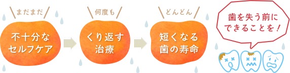 歯を失う前にできることを