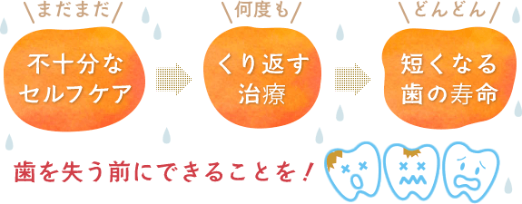 歯を失う前にできることを